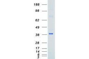 Western Blotting (WB) image for Tribbles Pseudokinase 2 (TRIB2) (Transcript Variant 1) protein (Myc-DYKDDDDK Tag) (ABIN2734213)