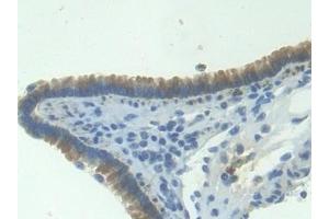 Detection of ITaC in Mouse Lung Tissue using Polyclonal Antibody to Interferon Inducible T-Cell Alpha Chemoattractant (ITaC) (CXCL11 抗体  (AA 22-100))