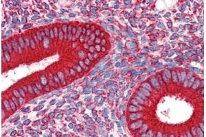 Human Uterus (formalin-fixed, paraffin-embedded) stained with HSP90B1 antibody ABIN462106 at 10 ug/ml followed by biotinylated secondary antibody, alkaline phosphatase-streptavidin and chromogen. (GRP94 抗体)