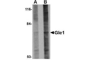 Western blot analysis of Gle1 in 293 cell lysate with AP30367PU-N Gle1 antibody at (A) 1 and (B) 2 μg/ml. (GLE1 抗体  (Center))