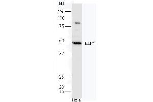 HeLa cell lysates probed with Rabbit Anti-ELP4 Polyclonal Antibody, Unconjugated (ABIN2559624) at 1:300 in 4˚C. (ELP4 抗体  (AA 321-424))