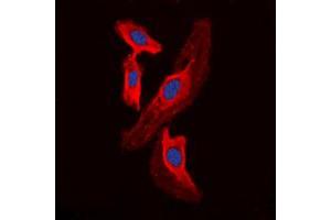 Immunofluorescent analysis of FHIT staining in HEK293T cells. (FHIT 抗体  (Center))