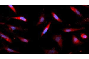 Immunofluorescence (IF) image for anti-AlkB, Alkylation Repair Homolog 3 (ALKBH3) (AA 1-286) antibody (APC) (ABIN5565112) (ALKBH3 抗体  (AA 1-286) (APC))