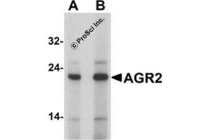 Western Blotting (WB) image for anti-Anterior Gradient Homolog 2 (Xenopus Laevis) (AGR2) (N-Term) antibody (ABIN1077447) (AGR2 抗体  (N-Term))