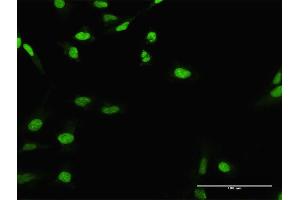 Immunofluorescence of purified MaxPab antibody to CIRBP on HeLa cell. (CIRBP 抗体  (AA 1-172))