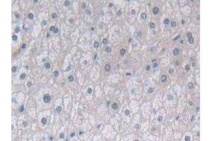Immunohistochemistry (IHC) image for anti-Proteasome (Prosome, Macropain) Subunit, beta Type, 6 (PSMB6) (AA 2-239) antibody (ABIN7436234)