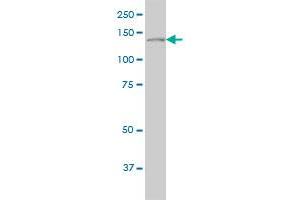 PLCG1 monoclonal antibody (M01), clone 2A2 Western Blot analysis of PLCG1 expression in Hela S3 NE .