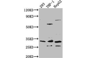 Western Blot Positive WB detected in: 293 whole cell lysate, THP-1 whole cell lysate, HepG2 whole cell lysate All lanes: COMT Antibody at 1:1000 Secondary Goat polyclonal to rabbit IgG at 1/50000 dilution Predicted band size: 31, 25 kDa Observed band size: 31 kDa (Recombinant COMT 抗体)