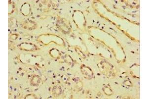 Immunohistochemistry of paraffin-embedded human kidney tissue using ABIN7146201 at dilution of 1:100 (OB Cadherin 抗体  (AA 637-796))