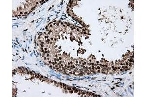 Immunohistochemical staining of paraffin-embedded liver tissue using anti-ERCC1 mouse monoclonal antibody. (ERCC1 抗体)