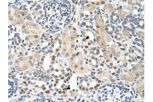 PSAT1 antibody was used for immunohistochemistry at a concentration of 4-8 ug/ml to stain Epithelial cells of renal tubule (arrows) in Human Kidney. (PSAT1 抗体  (N-Term))