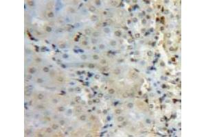 Used in DAB staining on fromalin fixed paraffin-embedded Kidney tissue (SUV420H2/KMT5C 抗体  (AA 2-279))