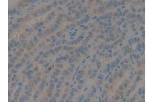 IHC-P analysis of Human Thyroid Tissue, with DAB staining. (GDF10 抗体  (AA 337-477))