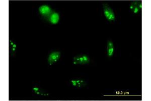 Immunofluorescence of monoclonal antibody to SENP5 on HeLa cell. (SENP5 抗体  (AA 2-109))