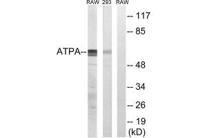 Western Blotting (WB) image for anti-ATP Synthase, H+ Transporting, Mitochondrial F1 Complex, alpha Subunit 1, Cardiac Muscle (ATP5A1) (Internal Region) antibody (ABIN1850831) (ATP5A1 抗体  (Internal Region))