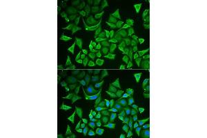 Immunofluorescence analysis of A549 cells using DTYMK antibody. (DTYMK 抗体  (AA 1-212))