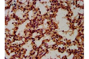 IHC image of ABIN7148531 diluted at 1:600 and staining in paraffin-embedded human lung tissue performed on a Leica BondTM system. (CPNE8 抗体  (AA 349-498))