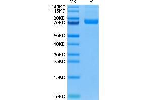 Biotinylated Human Siglec-10 on Tris-Bis PAGE under reduced condition. (SIGLEC10 Protein (AA 17-546) (His-Avi Tag,Biotin))