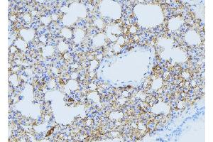 ABIN6275060 at 1/100 staining Mouse lung tissue by IHC-P. (DHODH 抗体  (Internal Region))