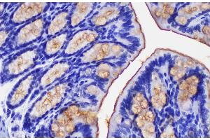 Immunohistochemistry of paraffin-embedded Mouse colon using Ceacam1 Polycloanl Antibody at dilution of 1:200 (CEACAM1 抗体)