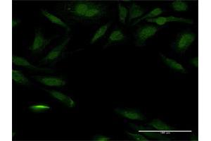 Immunofluorescence (IF) image for anti-Peroxisomal Biogenesis Factor 14 (PEX14) (AA 1-377) antibody (ABIN948241)