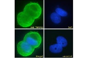 ABIN6391341 Immunofluorescence analysis of paraformaldehyde fixed MCF7 cells, permeabilized with 0. (RANKL 抗体  (Internal Region))