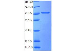 SDS-PAGE (SDS) image for Secretory Carrier Membrane Protein 3 (SCAMP3) (AA 2-170), (partial) protein (GST tag) (ABIN1095743) (SCAMP3 Protein (AA 2-170, partial) (GST tag))