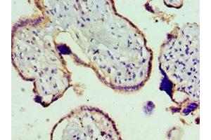 Immunohistochemistry (IHC) image for anti-Transient Receptor Potential Cation Channel, Subfamily M, Member 8 (TRPM8) (AA 980-1104) antibody (ABIN7172874)