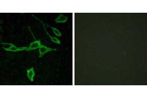 Peptide - +Western blot analysis of extracts from COLO205 cells, using HRH1 antibody.
