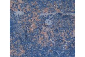 Used in DAB staining on fromalin fixed paraffin- embedded Kidney tissue (KLRK1 抗体  (AA 90-232))