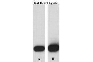 Image no. 2 for anti-Aconitase 2, Mitochondrial (ACO2) (Center) antibody (ABIN357262) (ACO2 抗体  (Center))