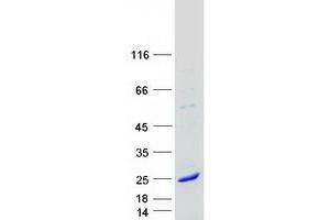 Myosin, Light Chain 5, Regulatory (MYL5) protein (Myc-DYKDDDDK Tag)