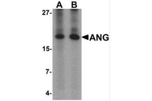 Western blot analysis of ANG in rat liver tissue lysate with Ang Antibody  at (A) 1 and (B) 2 μg/mL. (ANG 抗体  (Middle Region))