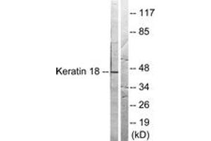 Western blot analysis of extracts from HeLa cells, treated with UV 5', using Keratin 18 (Ab-33) Antibody. (Cytokeratin 18 抗体  (AA 1-50))