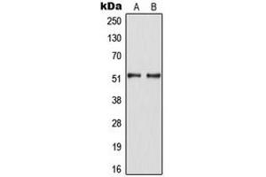 Western blot analysis of HNF4 alpha (pS313) expression in SW480 (A), HepG2 EGF-treated (B) whole cell lysates. (HNF4A 抗体  (pSer313))