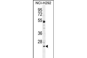 BCL7A Antibody (N-term) (ABIN654937 and ABIN2844580) western blot analysis in NCI- cell line lysates (35 μg/lane). (BCL7A 抗体  (N-Term))