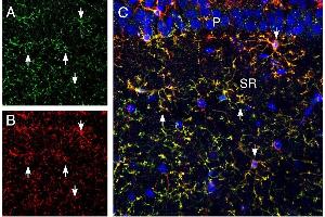 Multiplex staining of CX3CR1 and CD11b in rat hippocampus. (CX3CR1 抗体  (Extracellular))