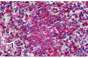 Human Spleen: Formalin-Fixed, Paraffin-Embedded (FFPE) (LCP1 抗体  (Headpiece Region))