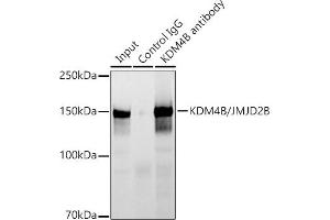 Immunoprecipitation analysis of 300 μg extracts of HCT116 cells using 3 μg KDM4B/JMJD2B antibody (ABIN7268329). (KDM4B 抗体)