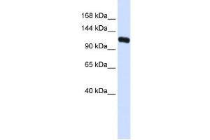KIF5C antibody used at 1 ug/ml to detect target protein. (KIF5C 抗体  (N-Term))