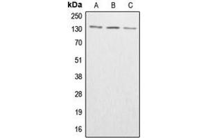 Western blot analysis of ABL1/2 (pY393/439) expression in HeLa colchicine-treated (A), SP2/0 colchicine-treated (B), H9C2 colchicine-treated (C) whole cell lysates. (ABL1/2 抗体  (C-Term, pTyr393, pTyr439))
