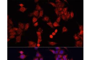 Immunofluorescence analysis of HeLa cells using SMAD2 Polyclonal Antibody at dilution of 1:100. (SMAD2 抗体)
