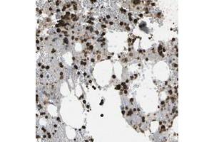 Immunohistochemical staining of human bone marrow with CACHD1 polyclonal antibody  shows strong cytoplasmic positivity in subsets of bone marrow poietic cells at 1:1000-1:2500 dilution. (CACHD1 抗体)