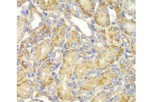 Immunohistochemistry of paraffin-embedded Rat kidney using PPP2R2A Polyclonal Antibody at dilution of 1:100 (40x lens). (PPP2R2A 抗体)