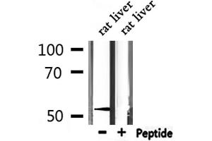 Western blot analysis of extracts from mouse liver, using MeCP2 antibody. (MECP2 抗体  (N-Term))