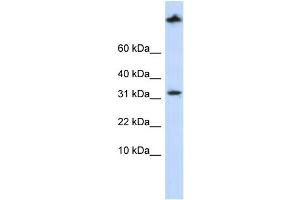 WB Suggested Anti-SCP2 Antibody Titration: 0. (SCP2 抗体  (Middle Region))