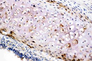 Anti-Collagen II antibody, IHC(F): Rat Trachea Tissue (COL2A1 抗体  (C-Term))