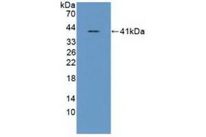 Detection of Recombinant ASNS, Human using Polyclonal Antibody to Asparagine Synthetase (ASNS) (Asparagine Synthetase 抗体  (AA 213-536))