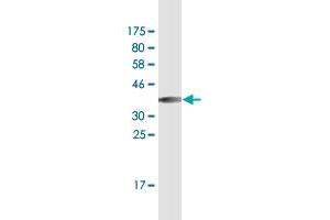 Western Blot detection against Immunogen (37. (SLC12A2 抗体  (AA 903-1010))