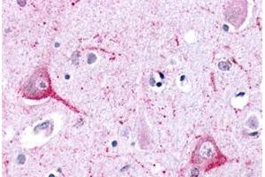 Immunohistochemical staining of human brain, neurons and glia with LPHN2 polyclonal antibody . (LPHN2 抗体  (N-Term))